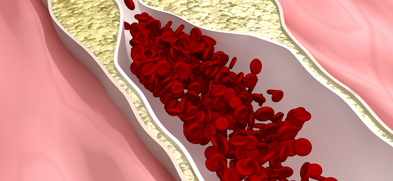 Videos in 12 languages