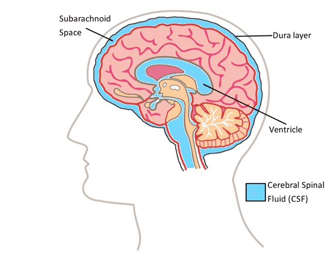 CSF within the brain