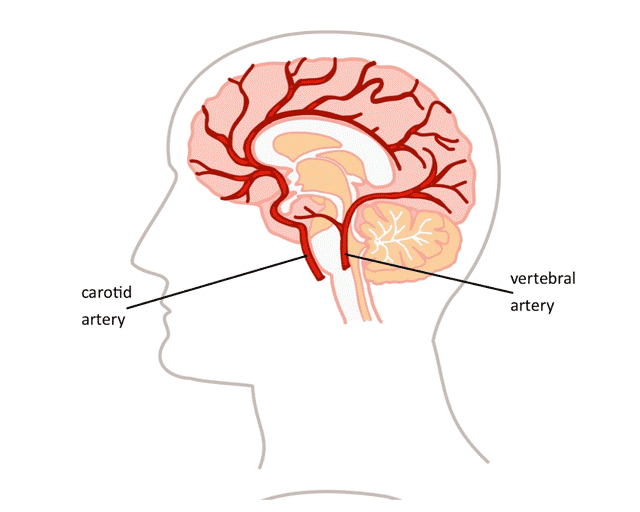 Arteries to the brain