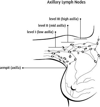 Axillary lymph nodes divided into 3 levels: level 1 (low axilla) in the lower part of the armpit, level 2 (mid axilla) in the middle part of the armpit, and level 3 (high axilla) in the upper part of the armpit.