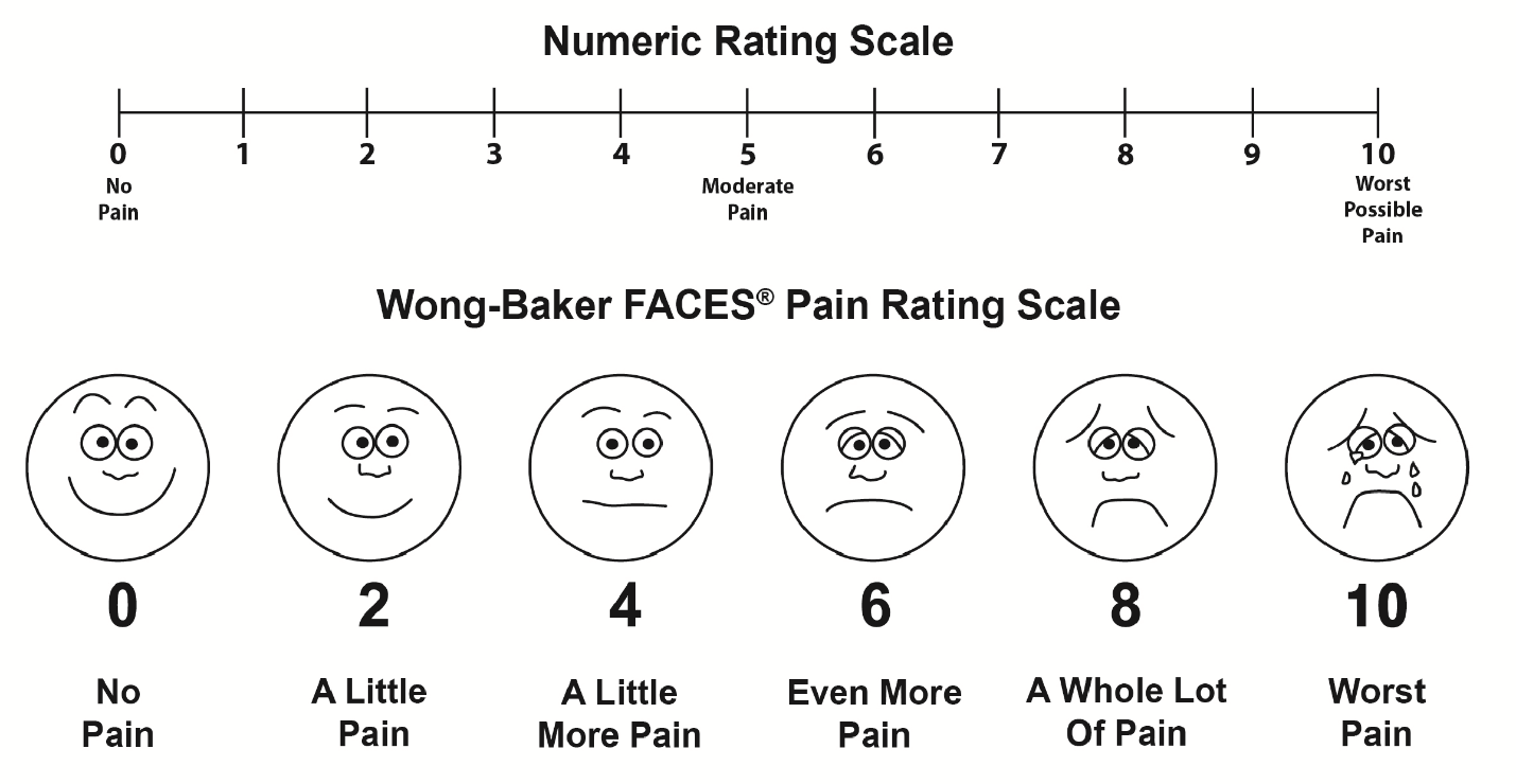 wong-baker-pain-scale