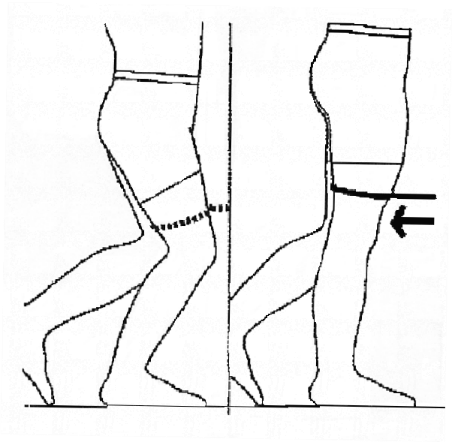 Elastic loop around leg of table and one thigh; hold onto table or stable object then slowly straighten leg to stretch loop while keeping heel on the floor.