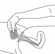 A hand twists the outer ring of the internal condom, which is filled with semen (cum), before pulling it out.