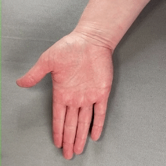 Close up fingers curling while the thumb stays open. How a hand hooks the handle of a grocery bag.