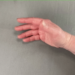 Close up of hand pinching. Shows finger pads of thumb and index touching and tips of thumb and index touching.