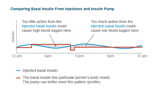 Graph of basal insulin needs compared to injected basal insulin over 24 hours.